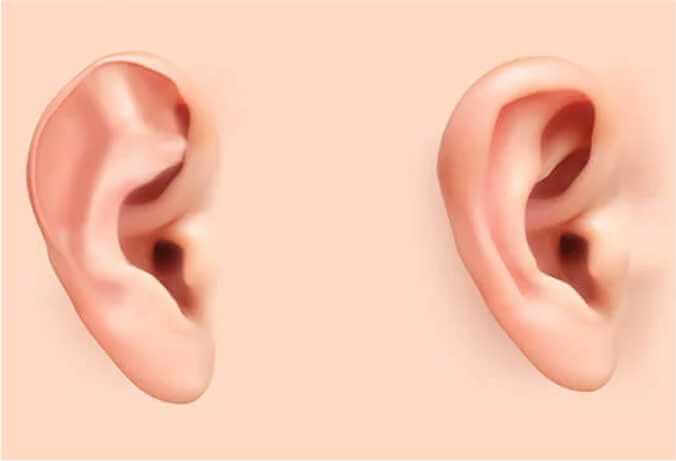 Benefits of Ear Correction Surgery