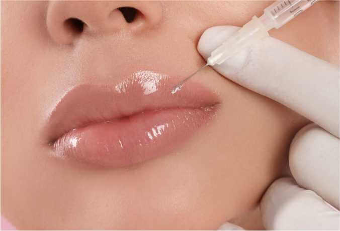 Benefits of Filler Treatment