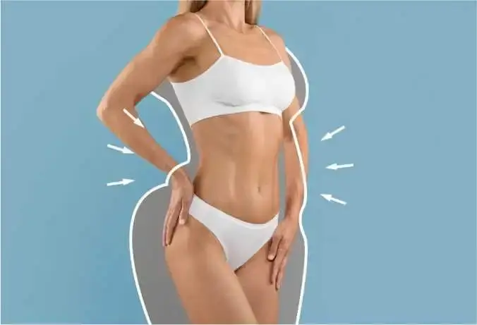 Benefits of Liposuction