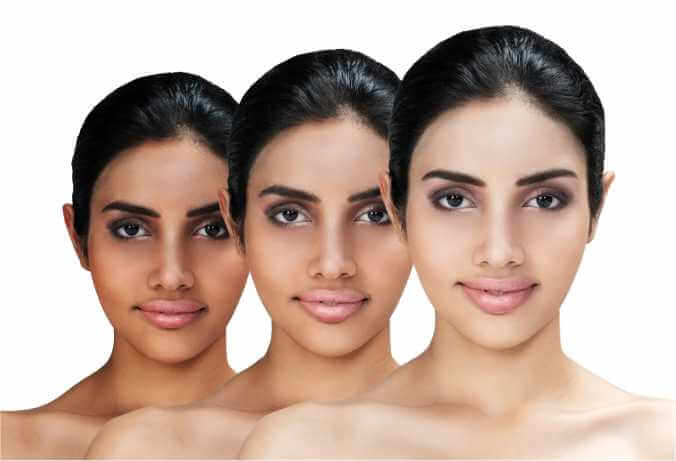 Benefits of Professional Skin Treatment