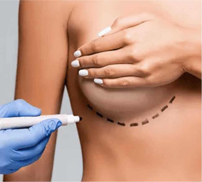 Ideal Candidates for Breast Augmentation