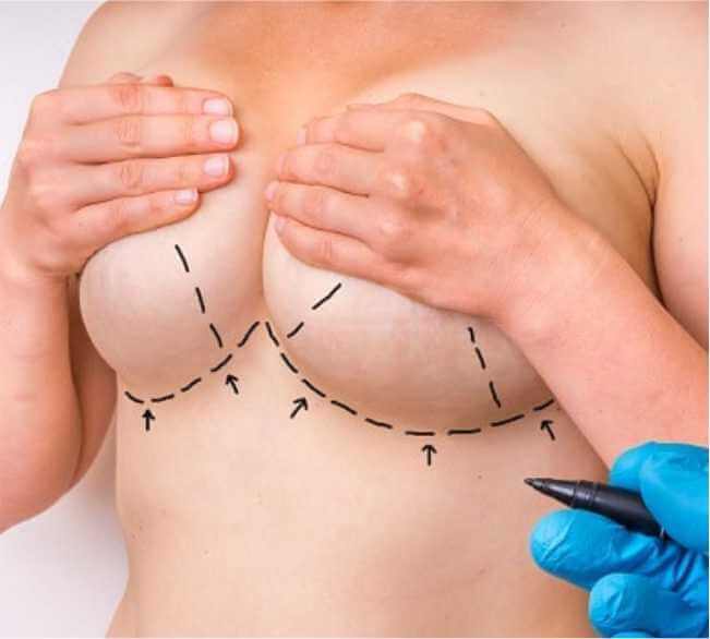 Right/Ideal Candidate for This Surgery/Procedure