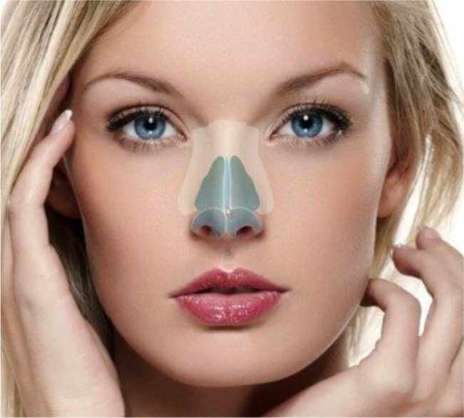 Ideal Candidates for Rhinoplasty