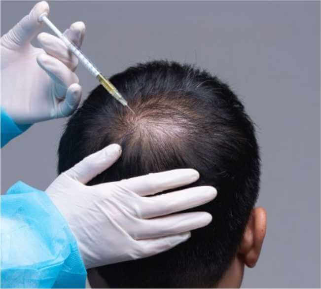 Who is the Right Candidate for PRP Treatment?