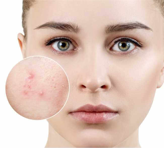 Ideal Candidates for Skin Treatment