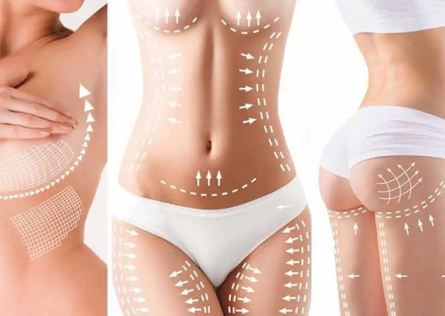 Benefits of Body Surgery