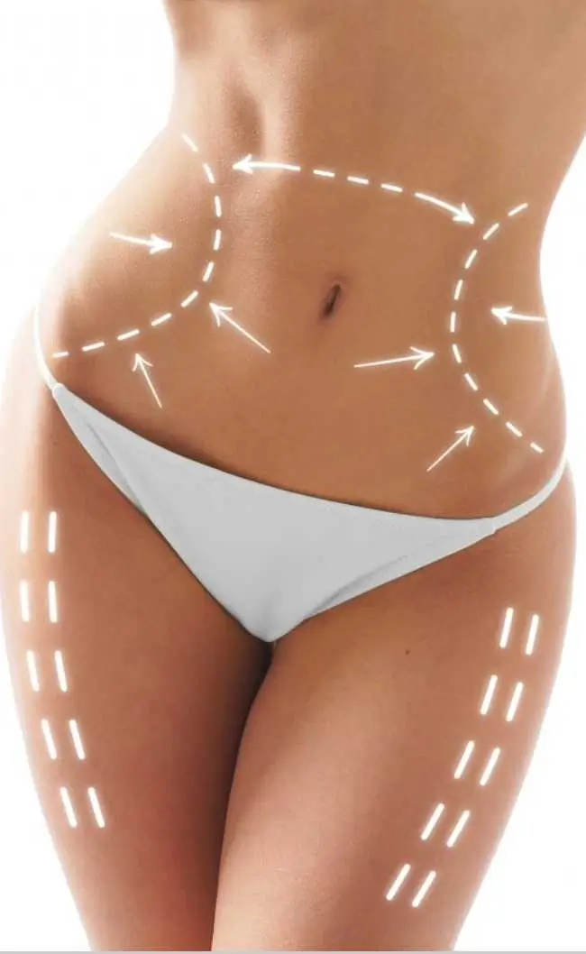 Who is the Right Candidate for Body Surgery?