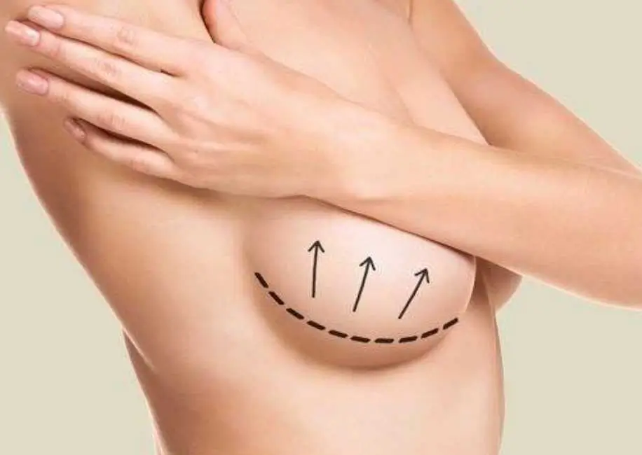 Benefits of Breast Surgery