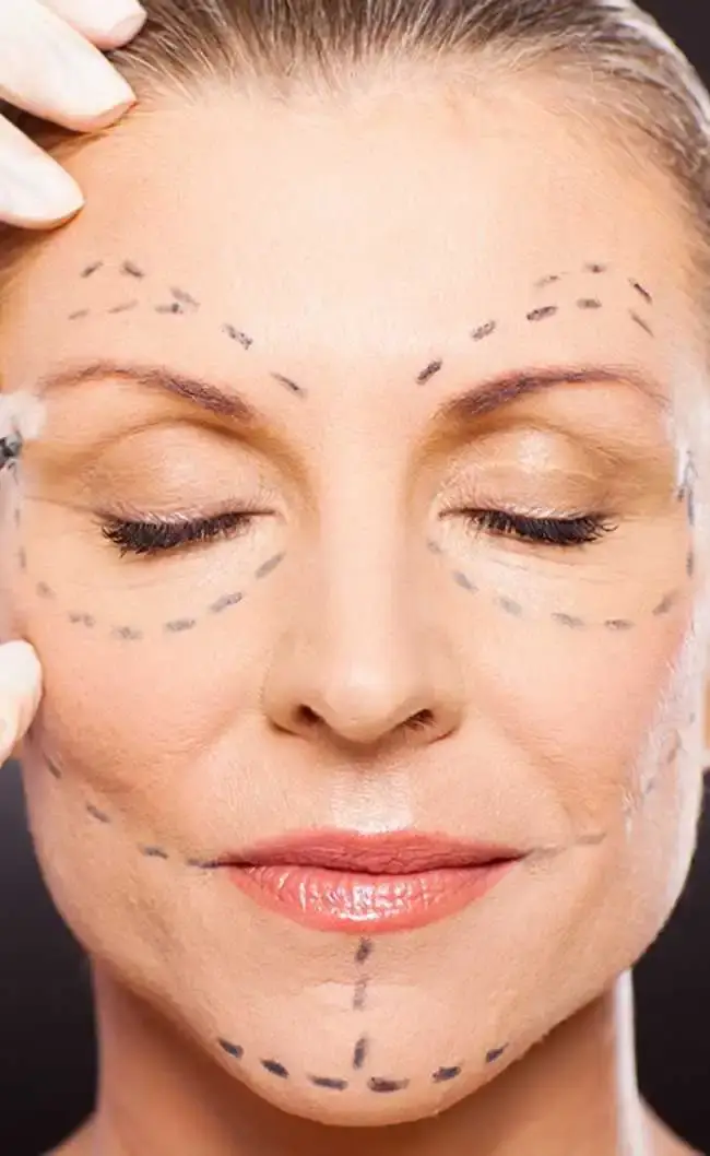 Who is the Right Candidate for Cosmetic Surgery?