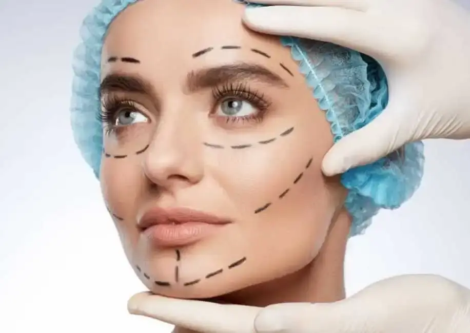 Benefits of Facial Surgery