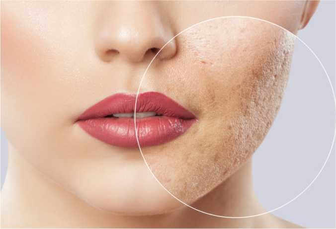 Benefits Of Scar Revision Surgery