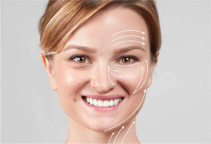 Benefits of Facelift Surgery