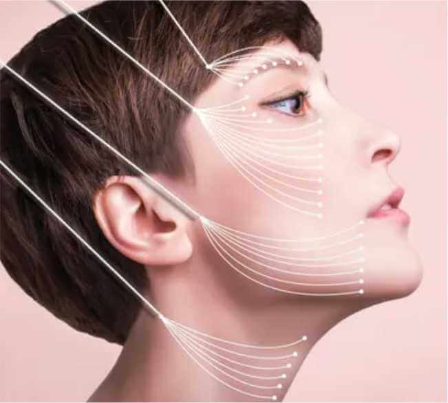 Ideal Candidates for Thread Lift