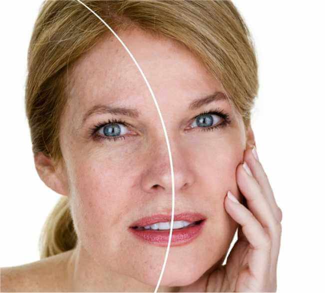 Ideal Candidates for Facelift Surgery