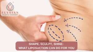 Liposuction Can Do for Yo