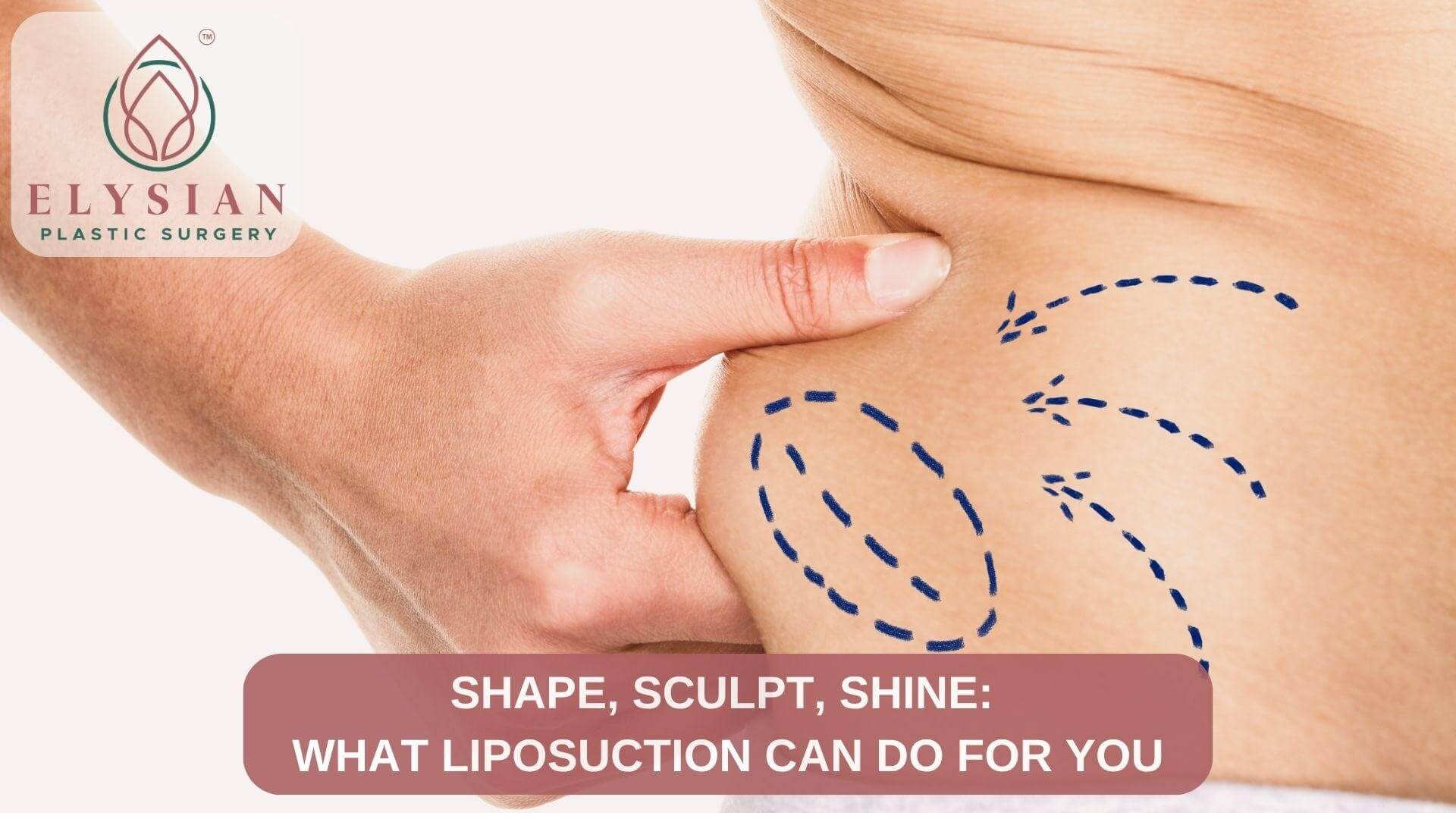 Liposuction Can Do for Yo