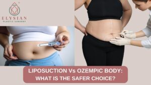 best plastic surgeons Surat