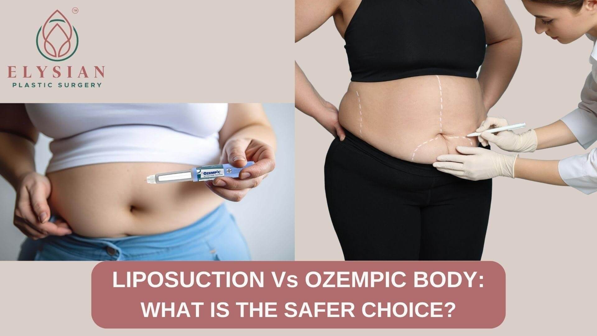 best plastic surgeons Surat