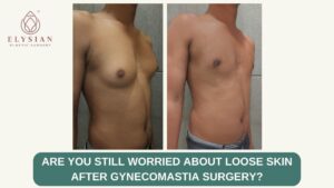 best plastic surgeons in Surat