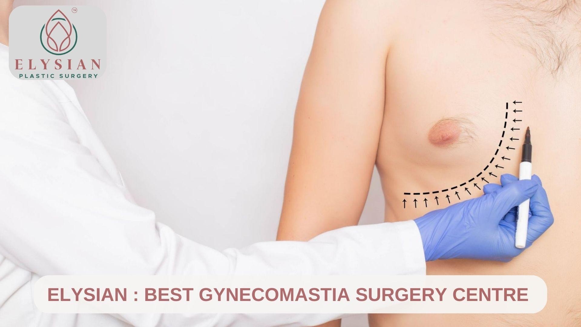 Best Gynecomastia Surgery Centre In Surat