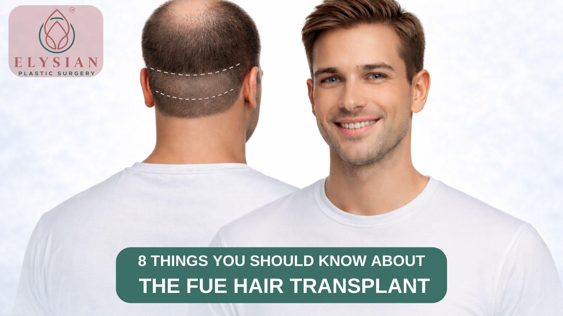 Hair Transplant In Surat