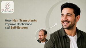 Best Hair Transplant in Surat⁠